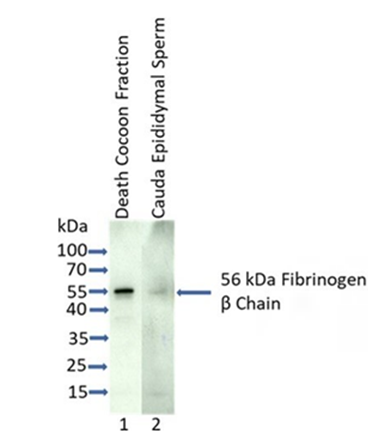 Figure 1: Immunoblot analysis of death cocoon fraction, and cauda epididymal sperm stained with anti-fibrinogen beta chain antibody revealed the presence of a 56kDa fibrinogen β chain polypeptide. Each lane contained 5µg protein.