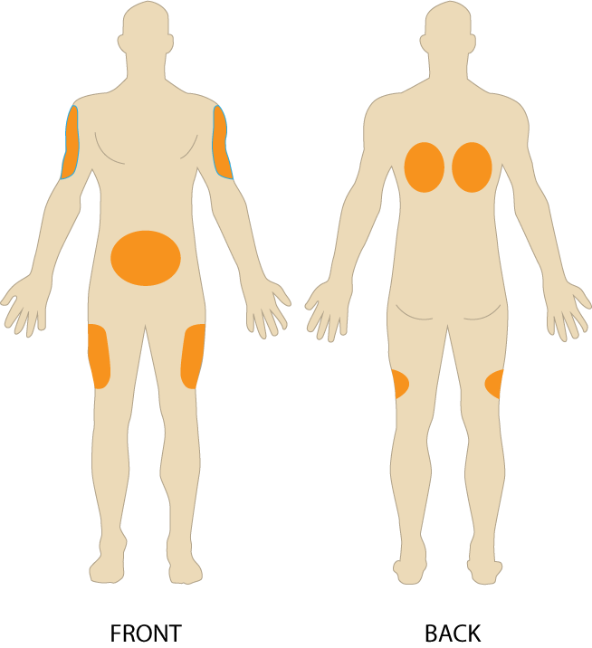 Figure 2: TB syringe [20].