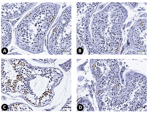 Figure 8: (A-D) photomicrograph of testis sections stained with anti-superoxide dismutase 2 (X 1000) (n = 10). (A) C group, (B) Sf-group, (C) MG-group, and (D) Sf+MG-group.