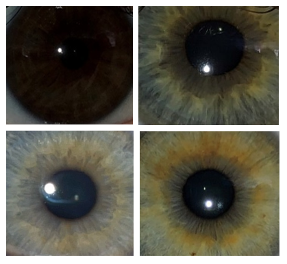 Figure 1: intermediate eye color.