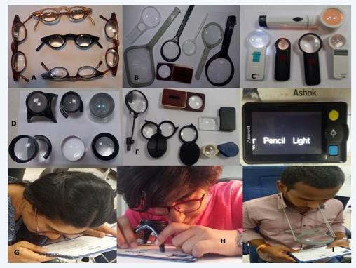 Figure 3: Optical low vision devices for near:(A) Spectacle magnifier; (B) Non-illuminated hand-held magnifier;(C) Self-illuminated hand-held magnifier; (D) Stand and dome magnifiers; (E) Pen magnifier and foldable pocket magnifiers; (F) Portable digital CCTV-type magnifier; (G) Reading with spectacle magnifier; (H) Reading with cut away stand magnifier; (I) Reading with neck magnifier.