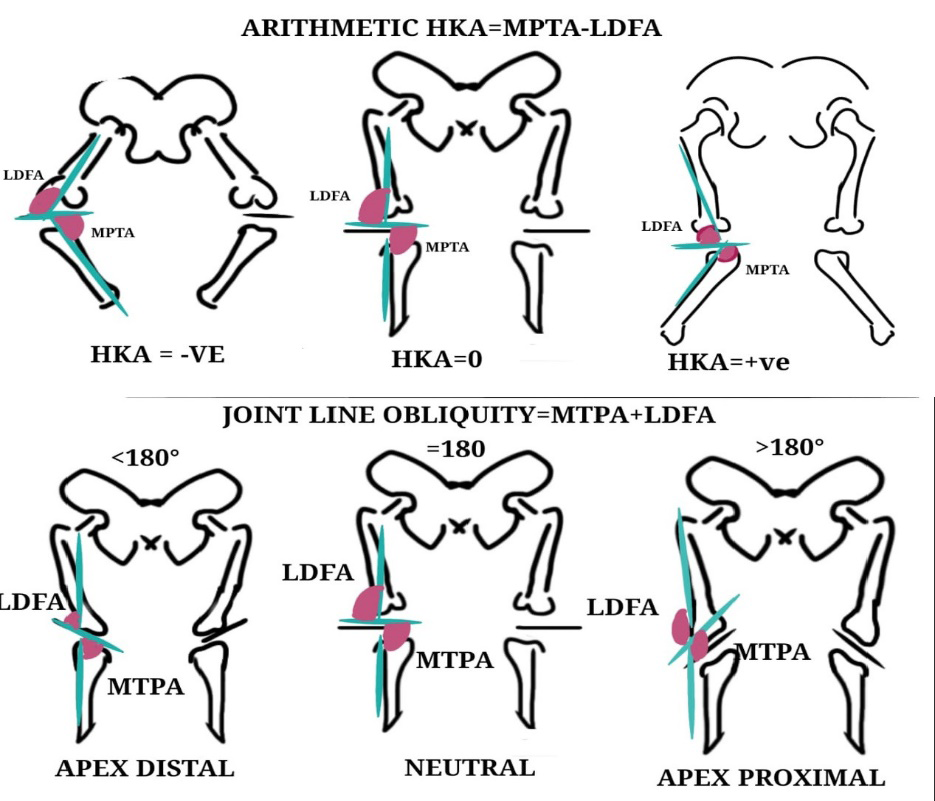 Figure 2: Types of aHKA and JLO based on CPAK classification.
