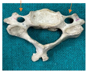 Figure 1: The oval shape.