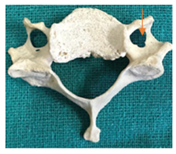 Figure 3: The double.