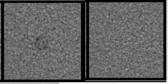 Figure 3: Seventeen 2AFC studies (FBP: 4 studies and ASIR: 13 studies) were generated by extracting a small region of interest around the lesion and at the corresponding location on the background image.