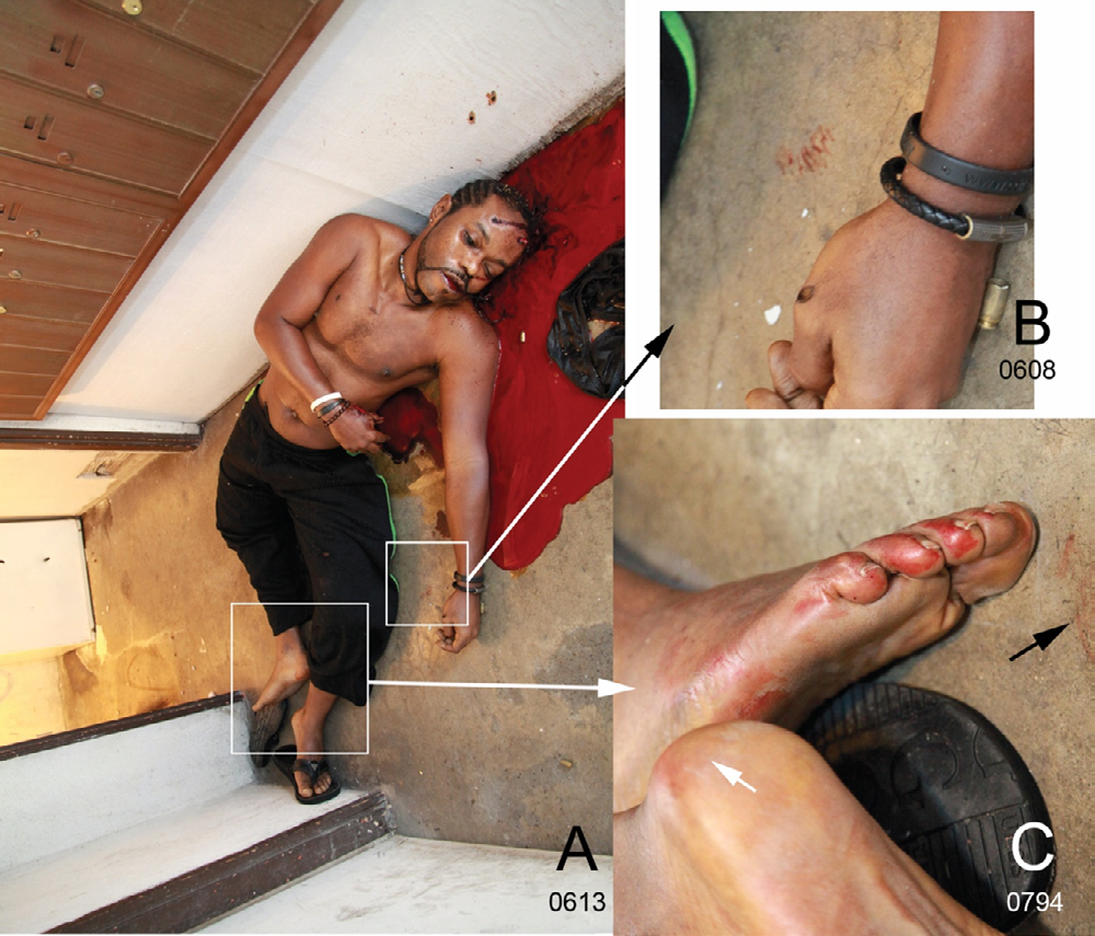 Figure 6: Blood transfers associated with the victim that occurred prior to the shooting, indicate the victim was bleeding. A. The victim; the areas within the squares show bloodstains that were deposited prior to the main bloodletting event caused by the shooting of the victim. B. A transfer bloodstain near the victim’s left hand. C. Transfer blood on the victim’s right foot sole and toes of his left foot; right heel (white arrow) was sampled for DNA in which revealed this blood to be from the victim. The black arrow points to a light blood transfer on the concrete floor.