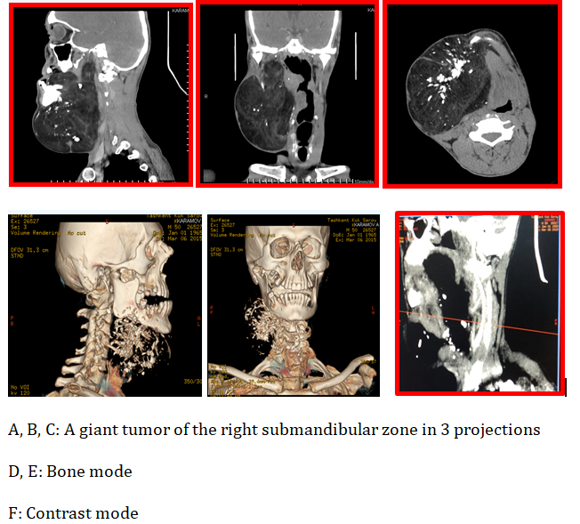 Figure 2: CT: Computed Tomography.