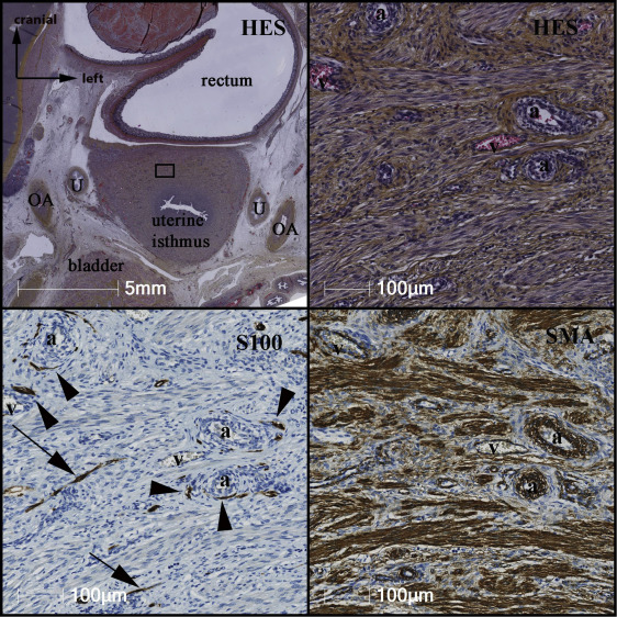 Figure 2: Courtesy ref no-9-Organization of nerve fibers within the myometrium on a cross-section at the uterine isthmus. Nerve fibers are preferably perivascular (black arrowheads), or they travel between muscle cells parallel to the axis of the muscular fibers (black arrows). a: arterioles. HES = hematoxylin eosin safran; OA = umbilical artery; SMA = smooth muscle actin; U = ureter; v = veins.