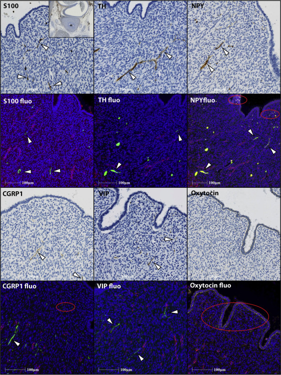 Figure 4: Courtesy ref no-9-Endometrial innervation at the uterine isthmus.