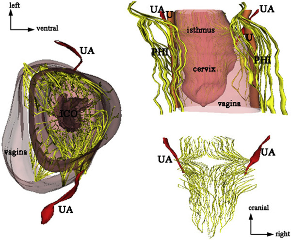 Figure 6: Courtesy ref no-9-Computer-assisted anatomic dissection of the uterine innervation shown in posterior and superior views. We focused our reconstruction on the lower part of the uterus, from the lower part of the uterine body to the tip of the cervix. It clearly illustrates the centripetal organization of the uterine nerve fibers, with fibers ascending to the uterine body, and descending to the cervix. ICO = internal cervical orifice; IHP/PHI = inferior hypogastric plexus; U = ureter; UA = uterine artery.