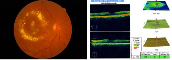 Figure 9: So we did not go for further intervension.