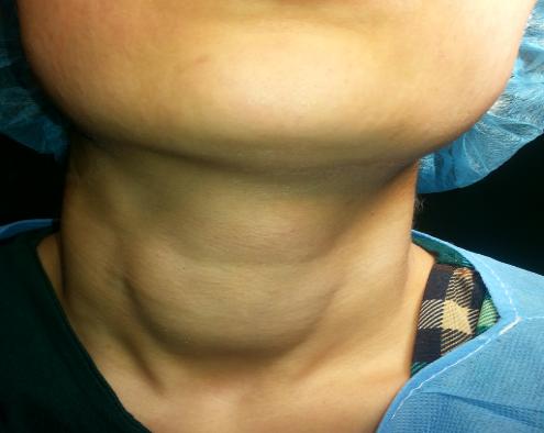 Figure 6: Preoperative.