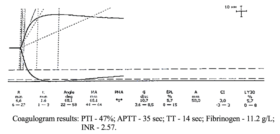 Figure 5: TEG parameters against the background of coagulogram data of patient K.