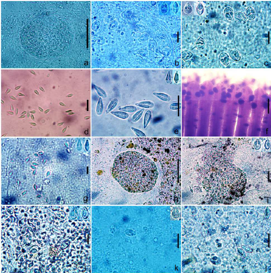 Figure 1: a. Cyst of _Myxobolus bhadrensis_. b. Spores of _Myxobolus bhadrensis_. c. Spores of _Myxobolus calbasui._ d, e. Spores of _Myxobolus catlae_. f. Gills with cyst of _Myxobolus kalavatiae_. g. Spores of _Myxobolus kalavatiae_. h. Cyst of _Myxobolus haldari_ i. Spores of _Myxobolus haldari_ j. Spores of _Myxobolus saranae_. k, l. Spores of _Myxobolus hosadurgensis_. Scale bars. a,h=50 µm; b=12 µm; c,g=15 µm; d,e=20 µm; f=200 µm; i,j=10 µm; k,l=15 µm.