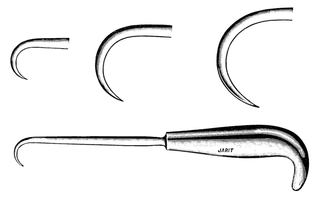 Figure 1: Demonstrating the hook to see pulling tibal cut out.