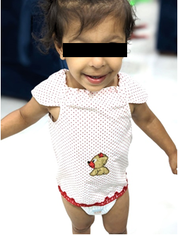 Figure 3: Image of the Infant at 3 Years of Age.
