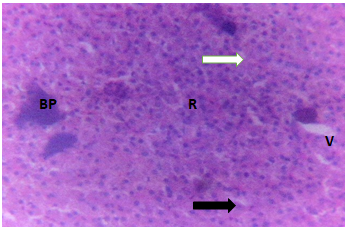 Figure 11: Liver of Clarias gariepinus juveniles exposed to 0.20 mg/l of DD-Force.