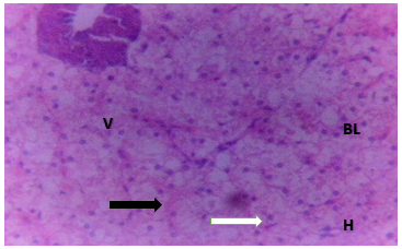 Figure 12: Liver of Clarias gariepinus juveniles exposed to 0.25 mg/l of DD-Force.