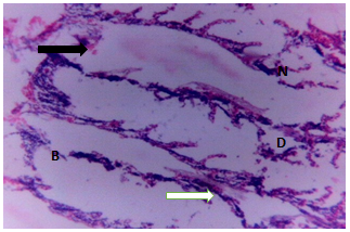 Figure 3: Gills of Clarias gariepinus exposed to 0.10 mg/l of DD-force.