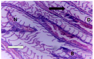 Figure 4: Gills of Clarias gariepinus exposed to 0.15 mg/l of DD-force.