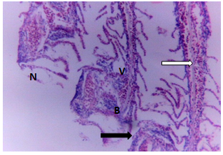 Figure 7: Gills of Clarias gariepinus exposed to 0.30 mg/l of DD-force.