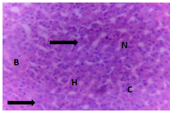 Figure 8: Liver of Clarias gariepinus juveniles in the control tank.