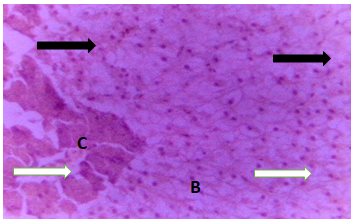 Figure 9: Liver of Clarias gariepinus juveniles exposed to 0.10 mg/l of DD-Force.