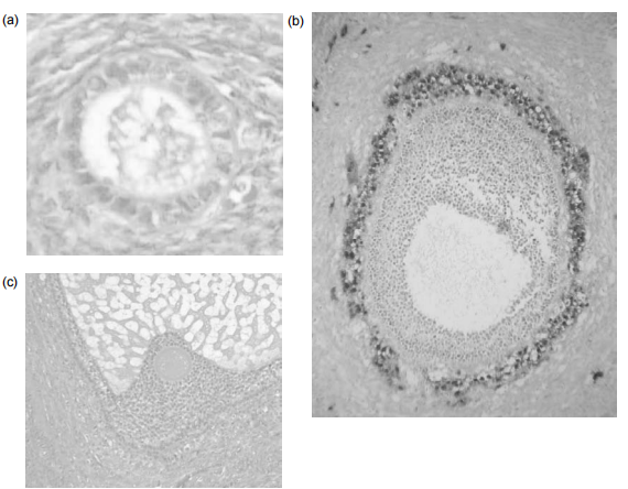 Figure 1: The development of a follicle, from (a) primordial, (b) small antral and (c) pre-ovulatory stages. (a) The primordial follicle is surrounded by a single layer of undifferentiated epithelial cells and is insensitive to gonadotropins. (b) The early antral follicle has well-differentiated theca (immunostained brown) and granulosa cell layers surrounding the developing antral cavity with the oocyte. (c) The pre-ovular follicle with the oocyte surrounded by the cumulus oophorus with well-differentiated granulosa and theca cell layers.
