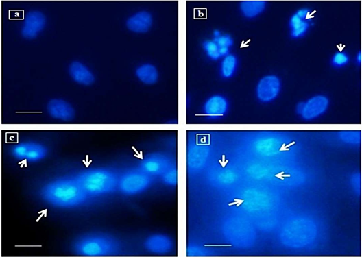 Figure 3: mRNA expression profile of apoptotic genes: a: control, b: 2.5µg/ml CdCl2, c: 5.0 µg/ml CdCl2, d: 10 µg/ml CdCl2.