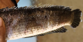 Figure 5: Ulcer.