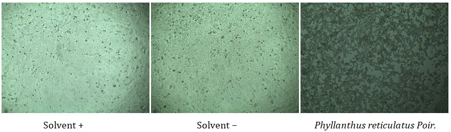Figure 1: Microscopic image after qualitative assay on HeLa cell line.