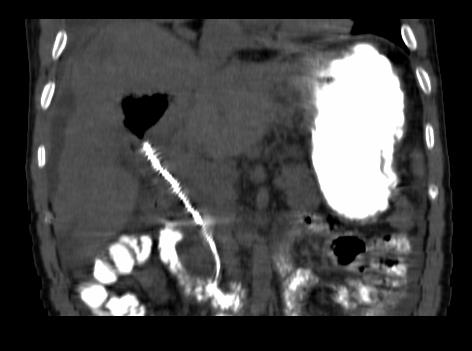 Figure 19