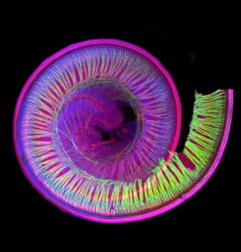 Figure 3: Spiral and fractal shape of the cochlea in the auditory system.
