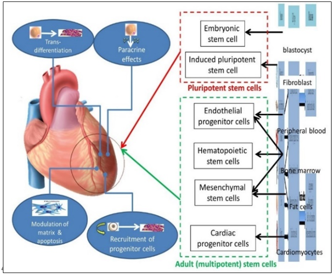 Figure 3: Types of adult (multipotent) and pluripotent stem cells for heart regeneration.
