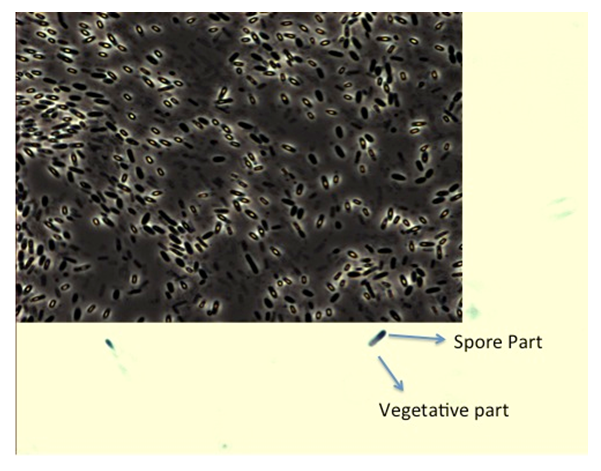 Figure 2: Colonies on M17 agar plates.