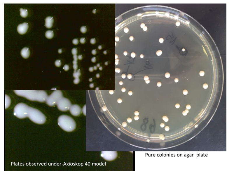 Figure 4: Clean colonies from different plates as observed under phase contrast microscope model (Axioskop 40 model).