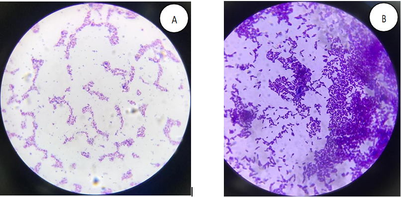 Figure 1: Gram Staining- (A) Gram Negative and (B) Gram Positive. Biochemical Tests for the Identification of Isolated Bacteria To identify and characterize bacterial species, a number of different biochemical tests were performed. Catalase test, coagulase test, sugar fermentation test, citrate test and methyl red test were performed.