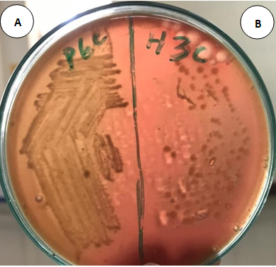 Figure 19: (A) Alpha Hemolysis by Streptococcus viridans on Blood Agar and (B) Gamma Hemolysis by Neisseria spp. on Blood Agar.
