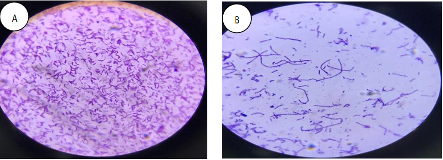 Figure 23: (A) Gram Positive Lactococci under Microscope and (B) Gram Positive Actinobacteria under Microscope.