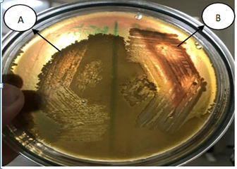 Figure 7: Hemolysis Test- (A) Alpha Hemolysis and (B) Beta Hemolysis.