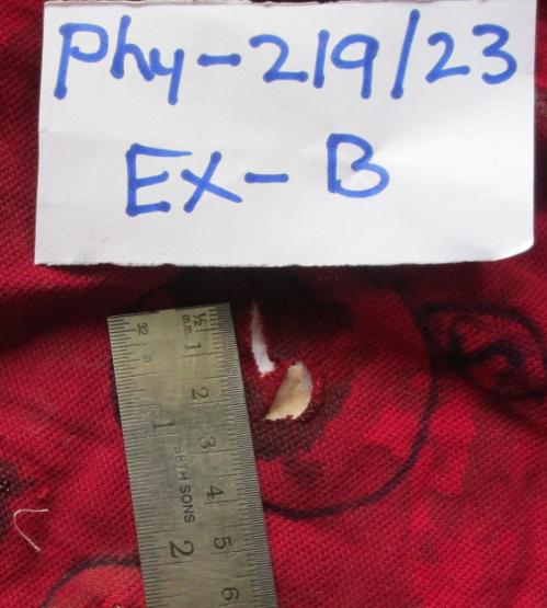 Figure 3: Stabbing/Cut Mark on Ex-B.