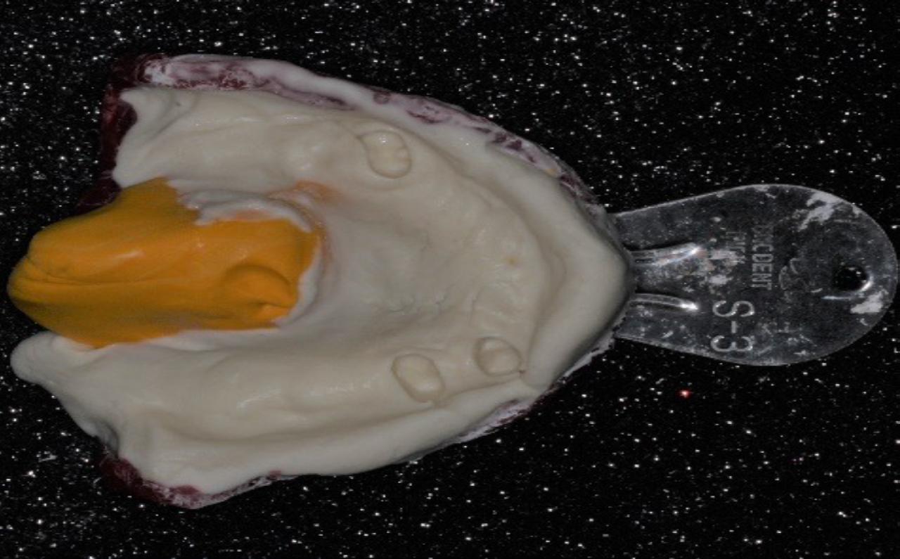 Figure 2: Upper molds.