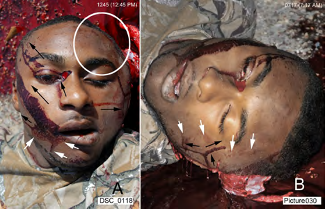 Figure 9: A. Bloodstains on the victim’s face; black arrows indicate the direction of blood flow when each stain was created. The head had changed positions from the time of the shotgun discharge to the position shown in the scene images. The victim’s forehead came in contact with dirt (circled). The white arrows point to a blood wipe that occurred immediately after the shotgun discharge by an assailant’s hand when the body was being moved. B. Transfer stains (white arrows): the time stamp on this image was likely 0617 (6:17 AM) or within one hour of the shooting; the bloodstream from the victim’s left nostril shown in A had not yet occurred. Three changes in the body position occurred, which are reflected by the Y-shaped stain. These bloodstreams could not have occurred in the found body position if the victim fell to that position immediately after the shotgun discharge. Black arrows show the direction of the blood flow. Transfer stains (at white arrows) occurred before the “Y” arms of the bloodstream. This image was color adjusted by Photoshop/Image/Adjustments/Hue-Saturation.