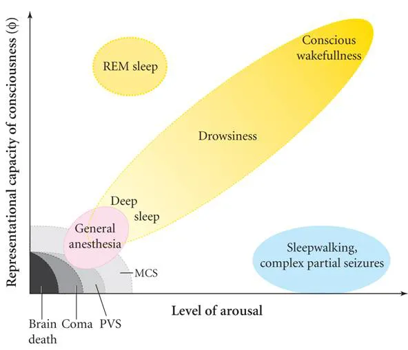 Figure 1: See where is Sleepwalking Near Awareness and Far Away from Coma. The “Expert” Opinion is Just Exaggeration.