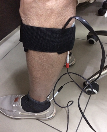 Figure 11: Noninvasive monitoring of peripheral artery disease (PAD) (Courtesy: (Dr Shyam Vasudeva Rao, Renalyx Health Systems, Bengaluru).