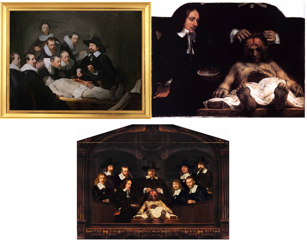 Figure 1: Reproductions of these paintings “Anatomy Lesson of Dr. Nicholas Tulp”, and the painting – “Anatomy Lesson of Dr. Deyman”.