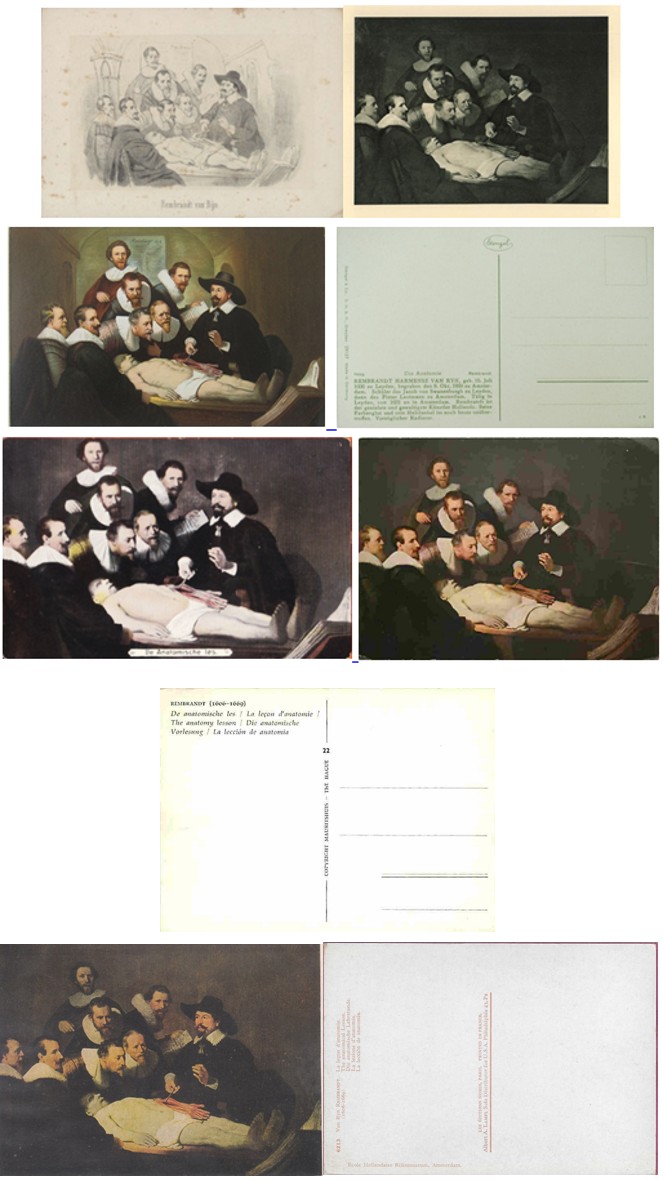 Figure 8: Philocartic and philatelic images of Rembrandt’s painting “The Anatomy Lesson of Dr. Nicolaes Tulp”.