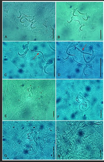 Figure 1: Gussevia asota microphotograph). Body-elongated, fusiform, moderate- sized worms with a narrow cephalic region; maximum width attained at the level of gonads. Cephalic lobes poorly developed, having two terminals and two bilateral. Two pairs of eyes, equidistant; the posterior pair larger than anterior pair. Ovate shaped pharynx present. Well-developed haptor present with anterior and posterior lobes having small glandular patches. Dorsal anchor, variable in length with superficial root, shaft curved with elongate point. Dorsal bar rod-shaped have slightly expanded ends. Ventral anchor comprises poorly differentiated roots, short anterior projection arising from tip of superficial root, shaft short with acute point. Filamentous ventral bar has ends curling around ventral anchor base. Hook pairs 1, 2, 3, 4, 6, and 7 similar with a slender shank; hook pair 5 modified, usually elongate. Eggs spherical in shape and smooth outline. Cirrus comprises a base from which a double-walled, coiled tube arises, having a coil of about 1.5 rings. Accessory piece basally articulated with cirrus having terminal flabellate piece possessing sclerotized ring. Vagina not observed. Vitellaria dense, dispersed along through intestinal caeca.