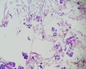 Figure 3: Body at Sarcina Ventriculi x40.