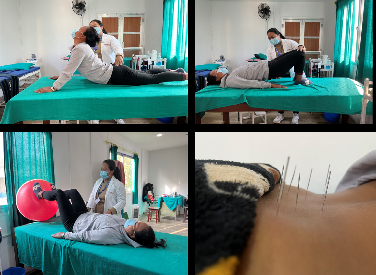 Figure 3: Rehabilitation with Physiotherapy Intervention along with Acupuncture.